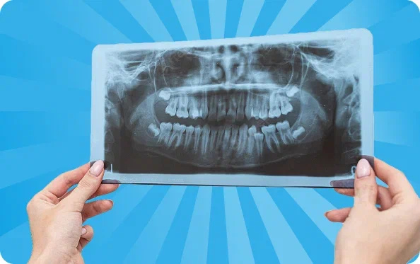 Новое оборудование в стоматологии г. Руза — панорамный снимок зубов